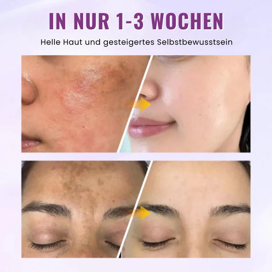 GlowGenix™ | Niacinamid Aufhellendes Sommersprossen Serum - Image 8