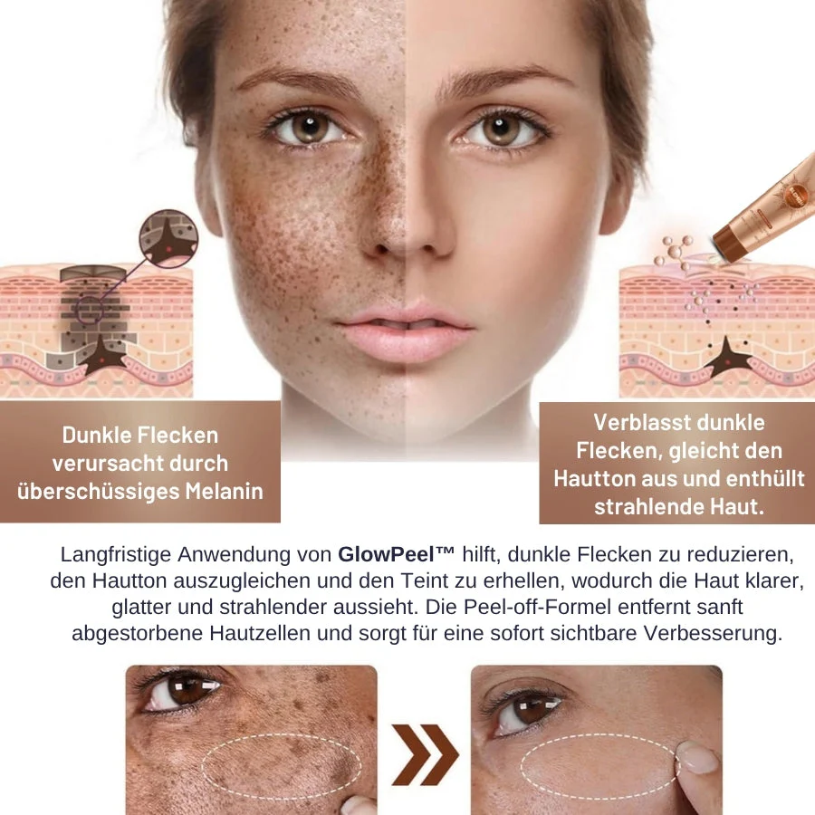 GlowPeel™ | Peeling-Gesichtsmaske - Image 5