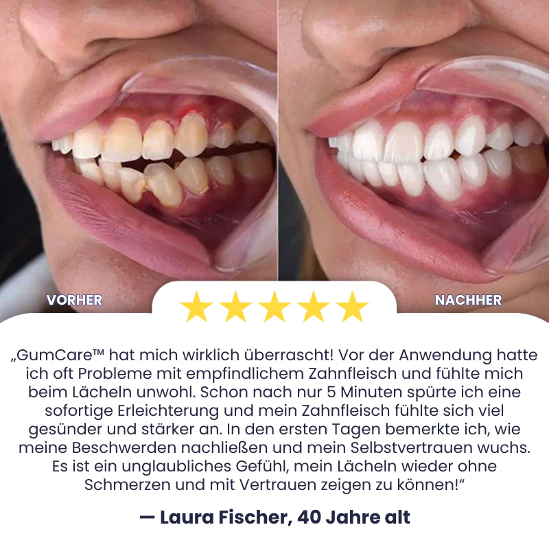 GumCare™ | Rote Lichttherapie-Gerät - Image 3