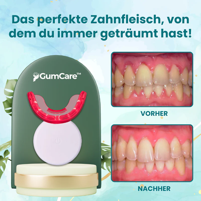 GumCare™ | Rote Lichttherapie-Gerät - Image 5