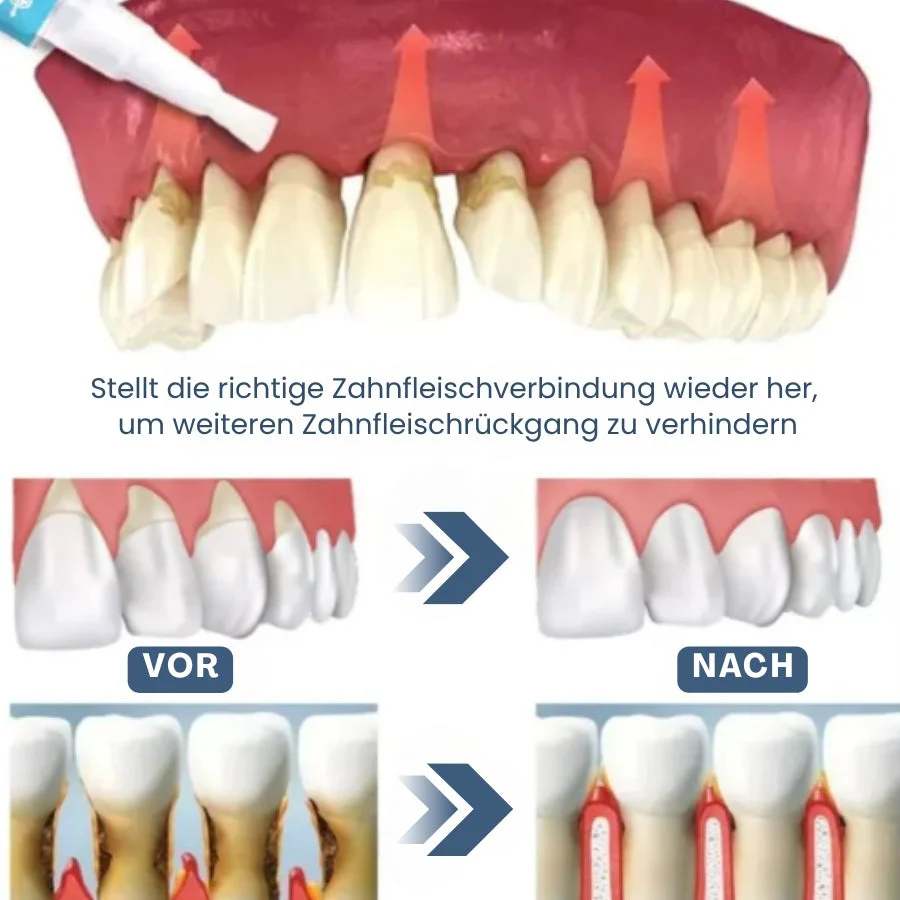GumRevive™ | Zahnfleisch Sofort-Gel - Image 2