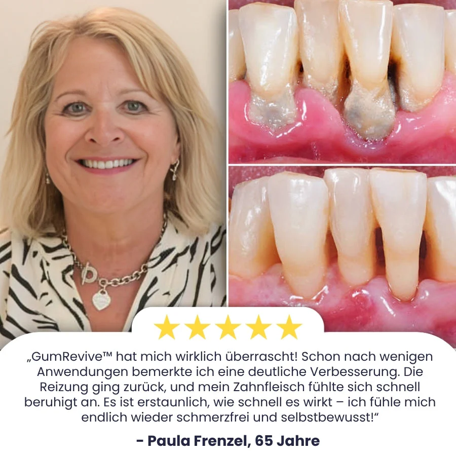 GumRevive™ | Zahnfleisch Sofort-Gel - Image 4