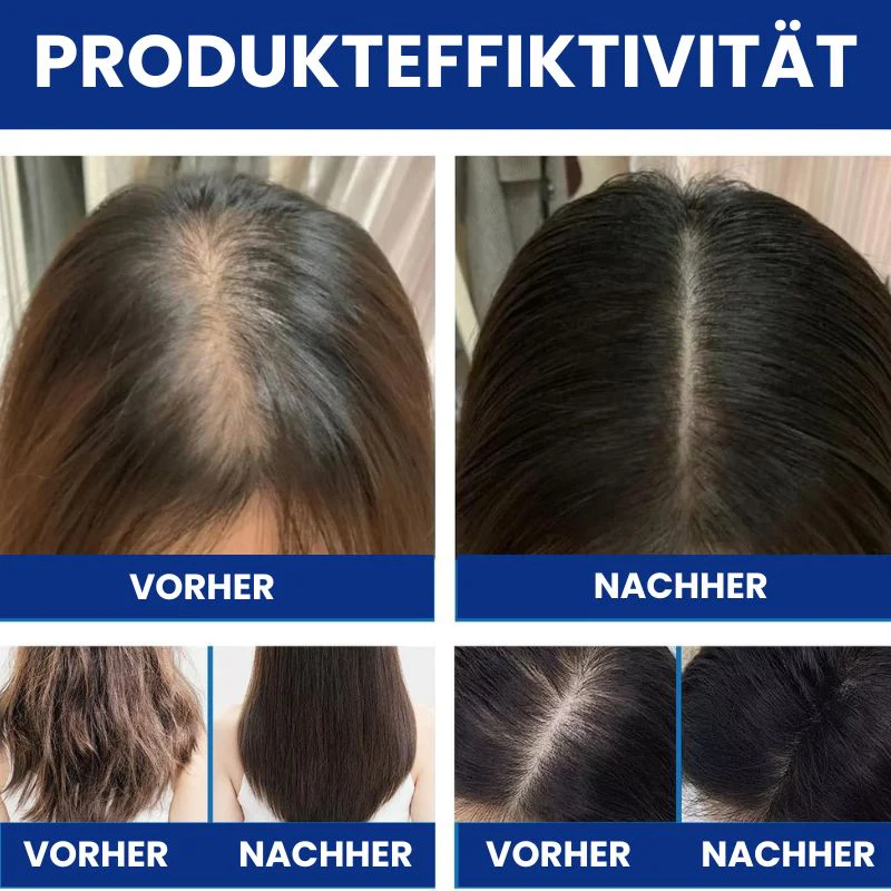 HaarRenew™ | 5 % Minoxidil mit Biotin Haarserum - Image 7