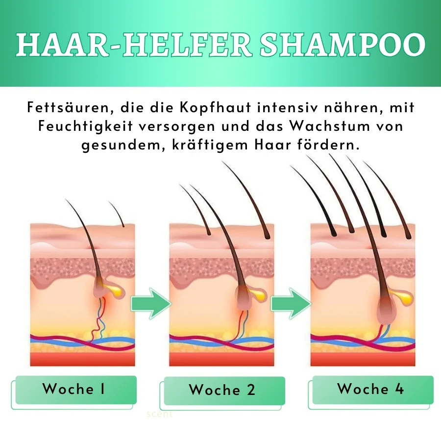 HairForce™ | Verabschieden Sie sich von Haarausfall und erhalten Sie in nur 2 Wochen volleres Haar! - Image 3
