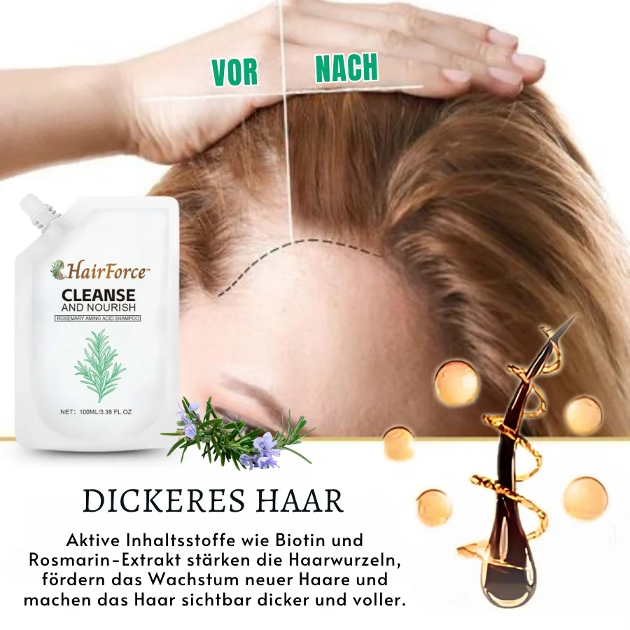 HairForce™ | Verabschieden Sie sich von Haarausfall und erhalten Sie in nur 2 Wochen volleres Haar! - Image 7