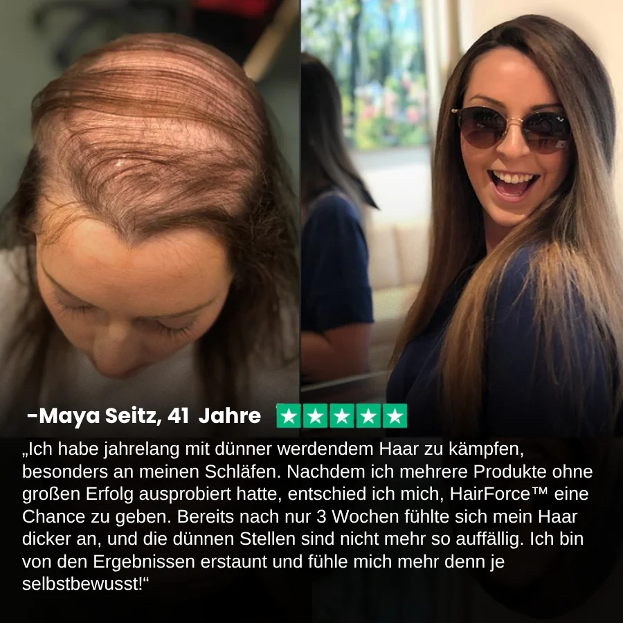 HairForce™ | Verabschieden Sie sich von Haarausfall und erhalten Sie in nur 2 Wochen volleres Haar! - Image 9