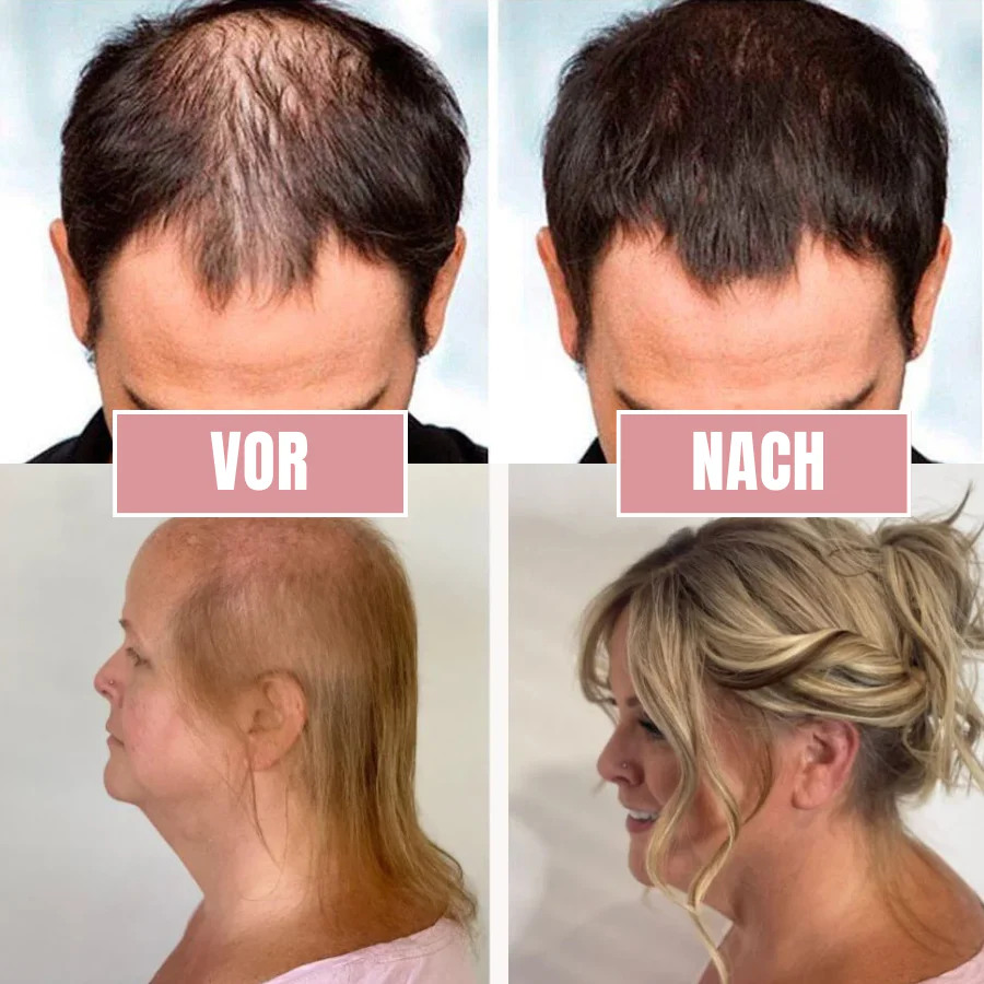 HairRevive™ | Reis-Nährstoff-Haarspray - Image 8