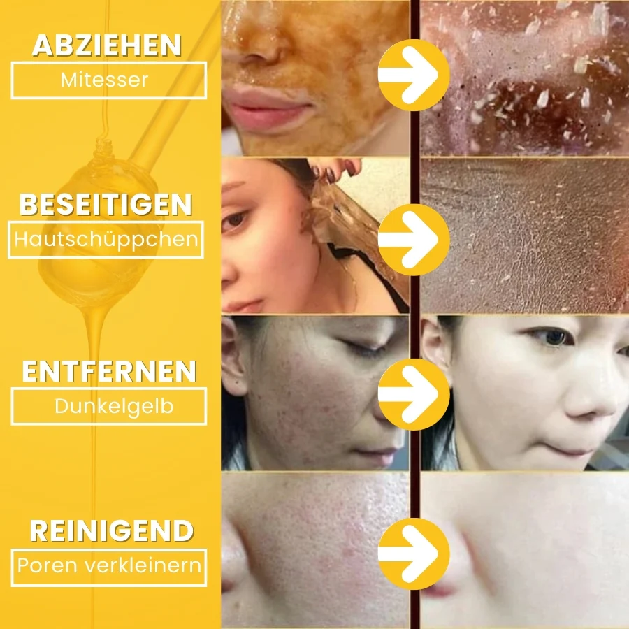 HoneyGlow™ | Kräuter-Peel-Off-Gesichtsmaske mit Honig für Flecken - Image 2