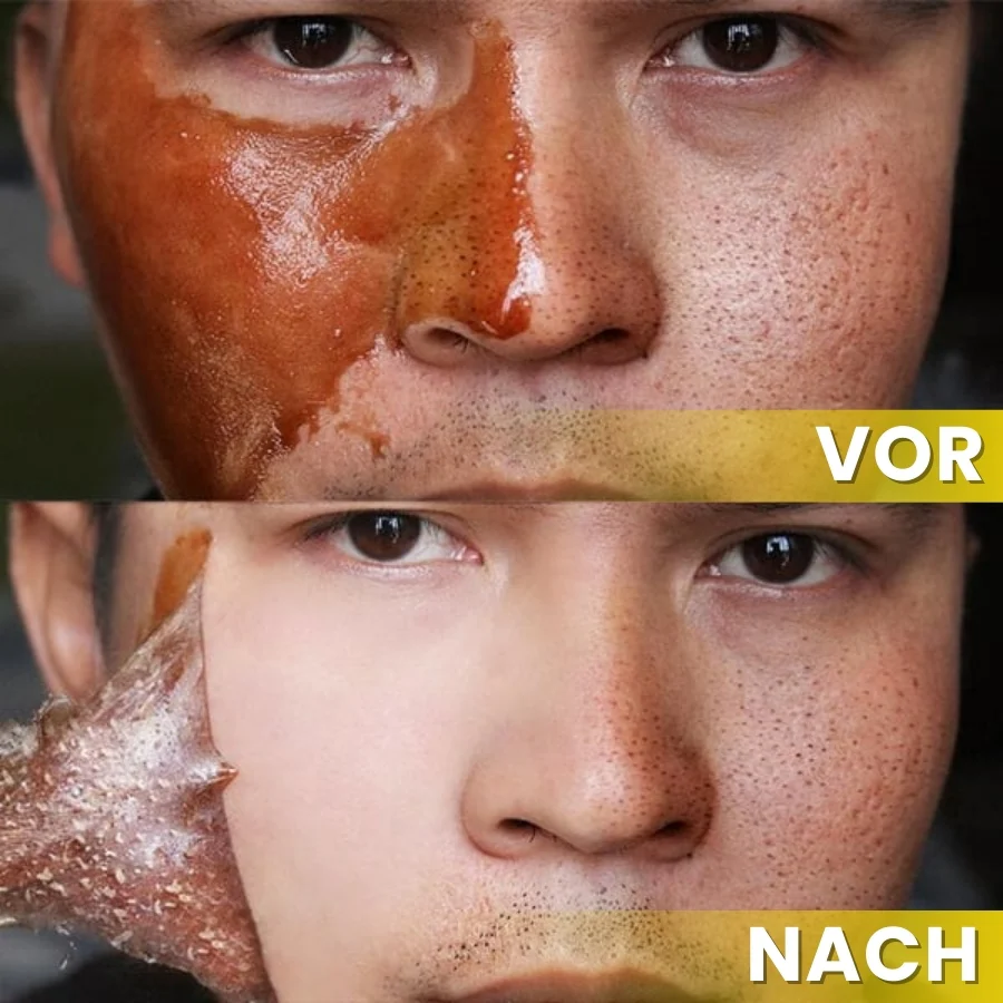 HoneyGlow™ | Kräuter-Peel-Off-Gesichtsmaske mit Honig für Flecken - Image 4