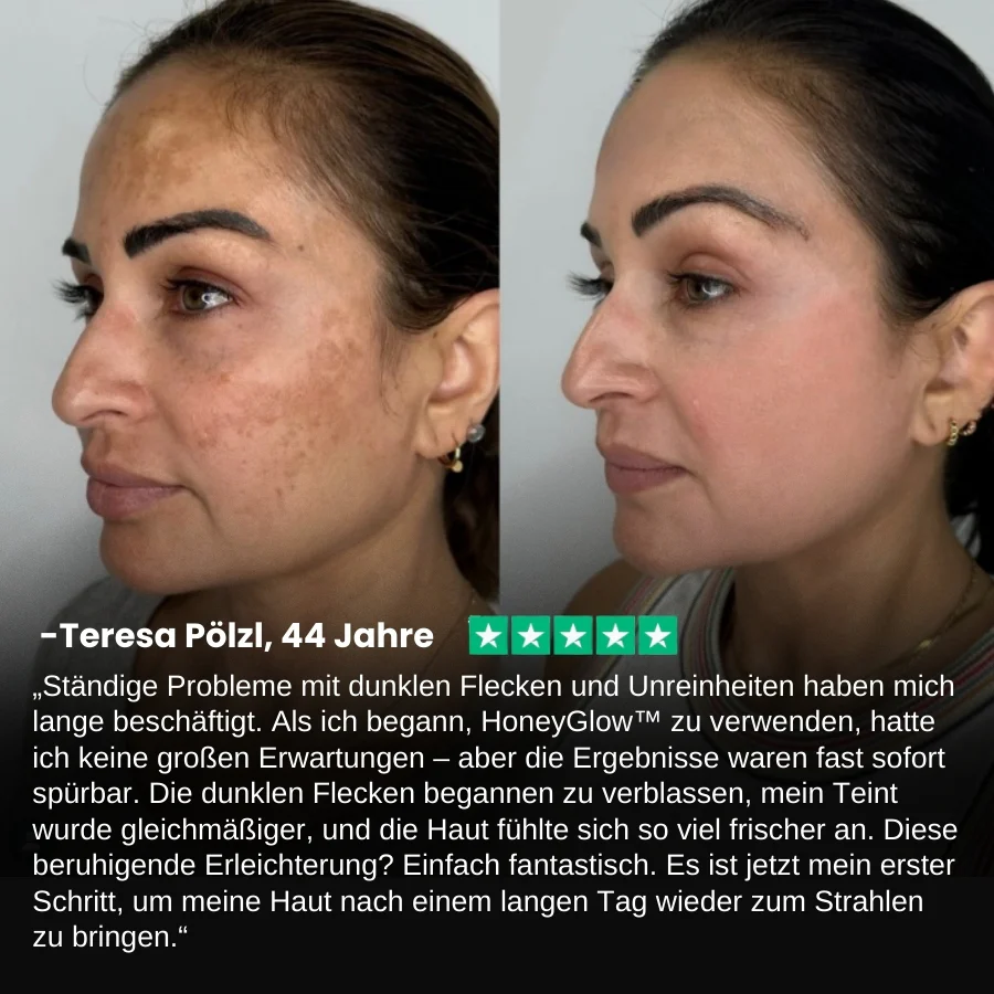 HoneyGlow™ | Kräuter-Peel-Off-Gesichtsmaske mit Honig für Flecken - Image 5