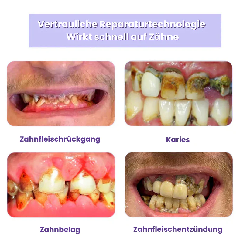 HydroDent™ | Beseitigt 97 % aller Karies und Zahnempfindlichkeit in nur 5 Tagen! - Image 6