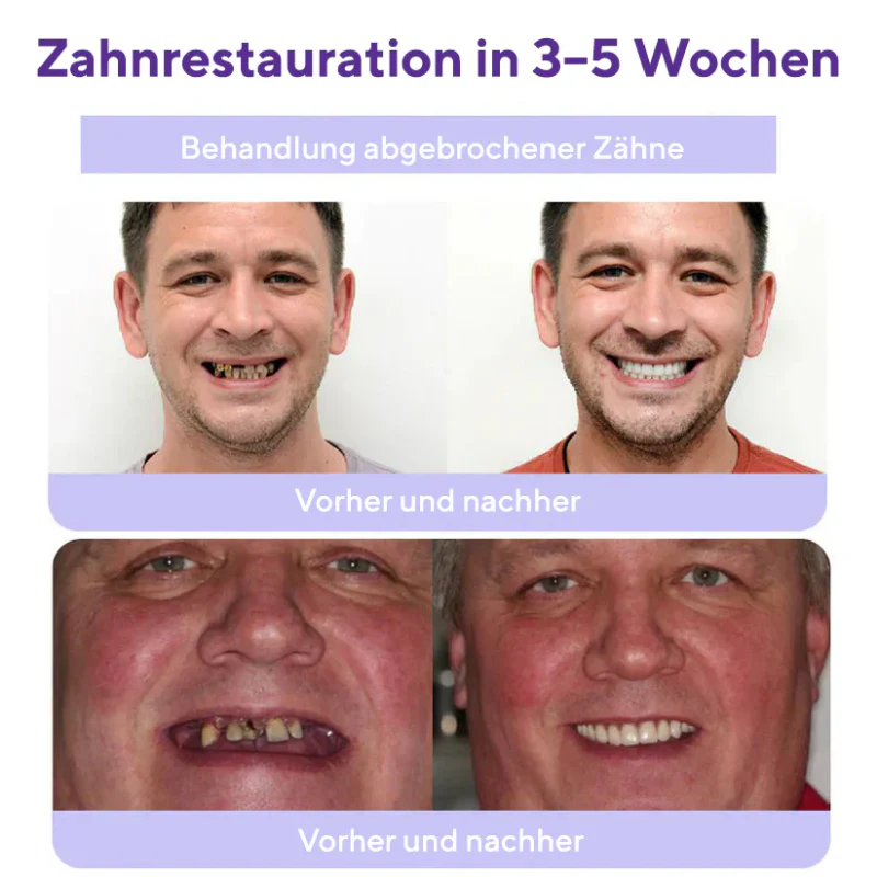 HydroDent™ | Beseitigt 97 % aller Karies und Zahnempfindlichkeit in nur 5 Tagen! - Image 7