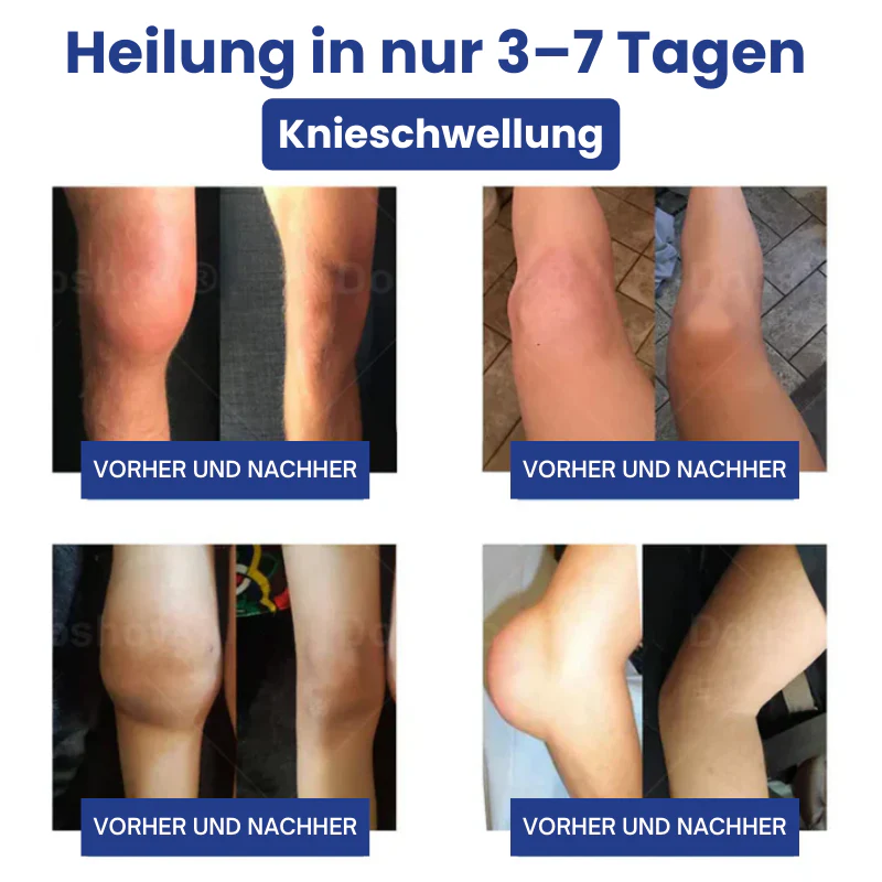 JointHeal™ | Gelenkpflege-Gel-Roller - Image 10