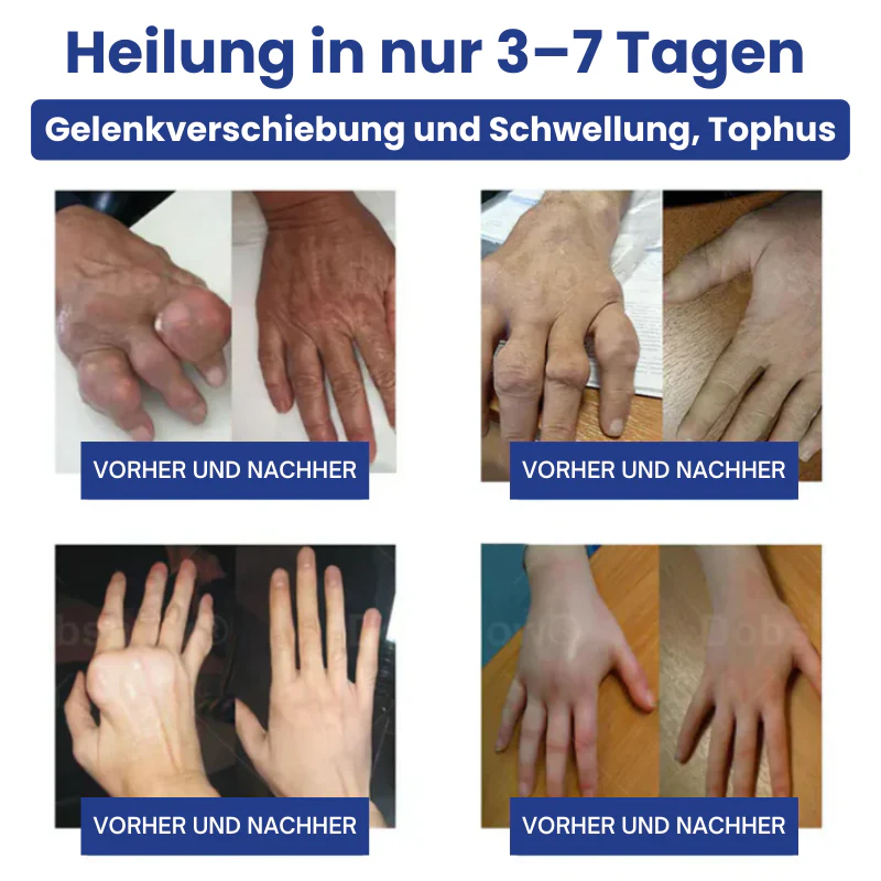 JointHeal™ | Gelenkpflege-Gel-Roller - Image 12
