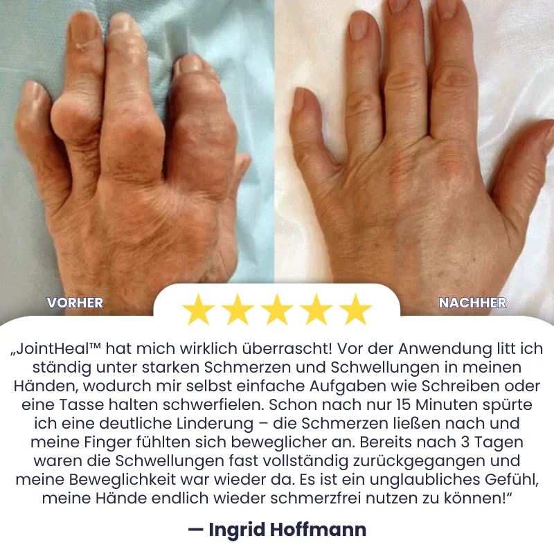 JointHeal™ | Gelenkpflege-Gel-Roller - Image 6