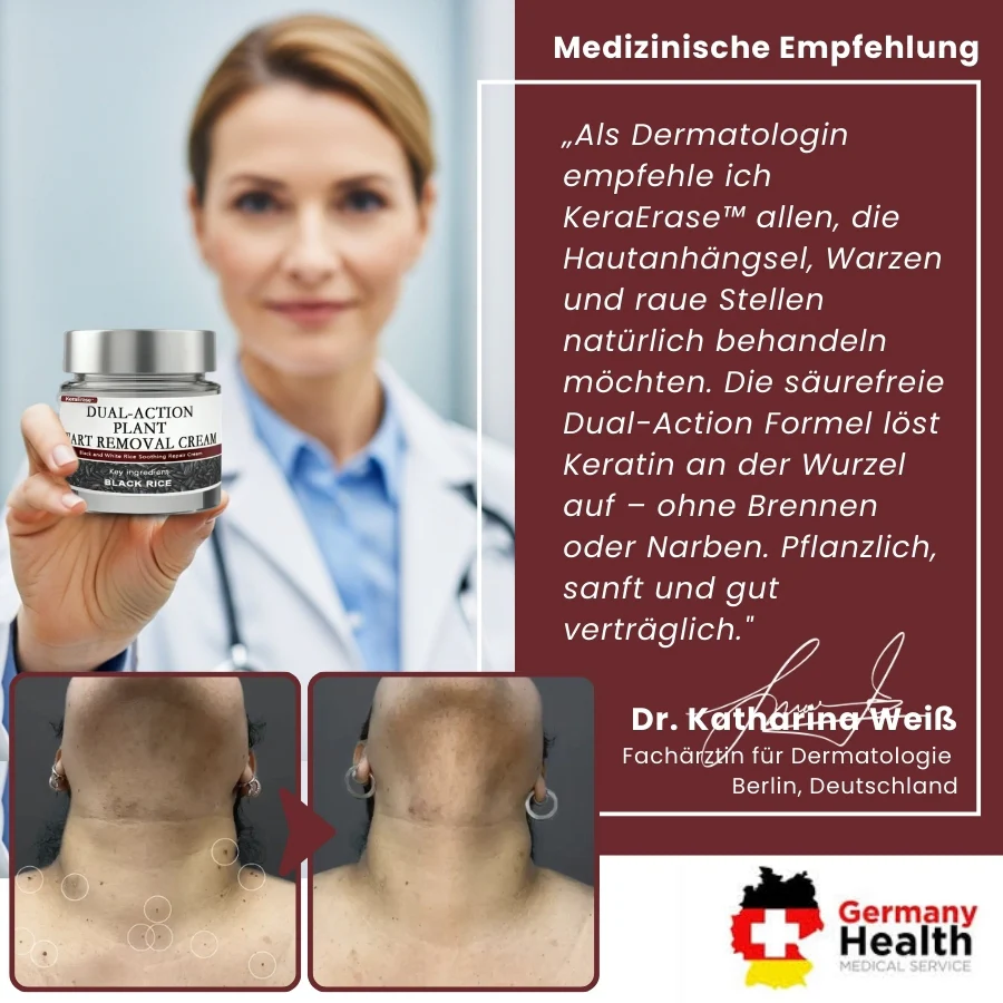 KeraErase™ | Pflanzliche Warzenentfernungscreme mit Doppelwirkung - Image 9