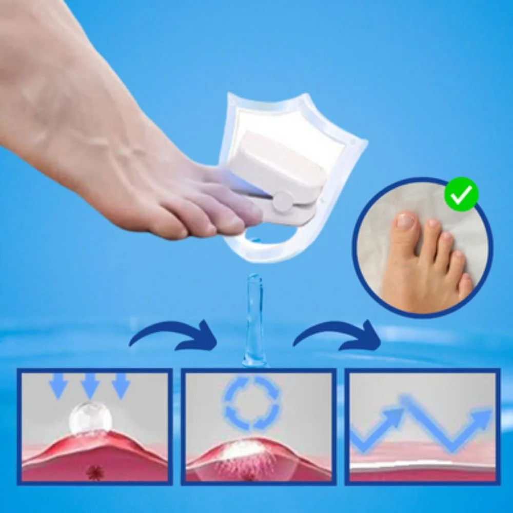 LaserKlar™ | Medizinischer Nagelpilz-Laser - Image 4