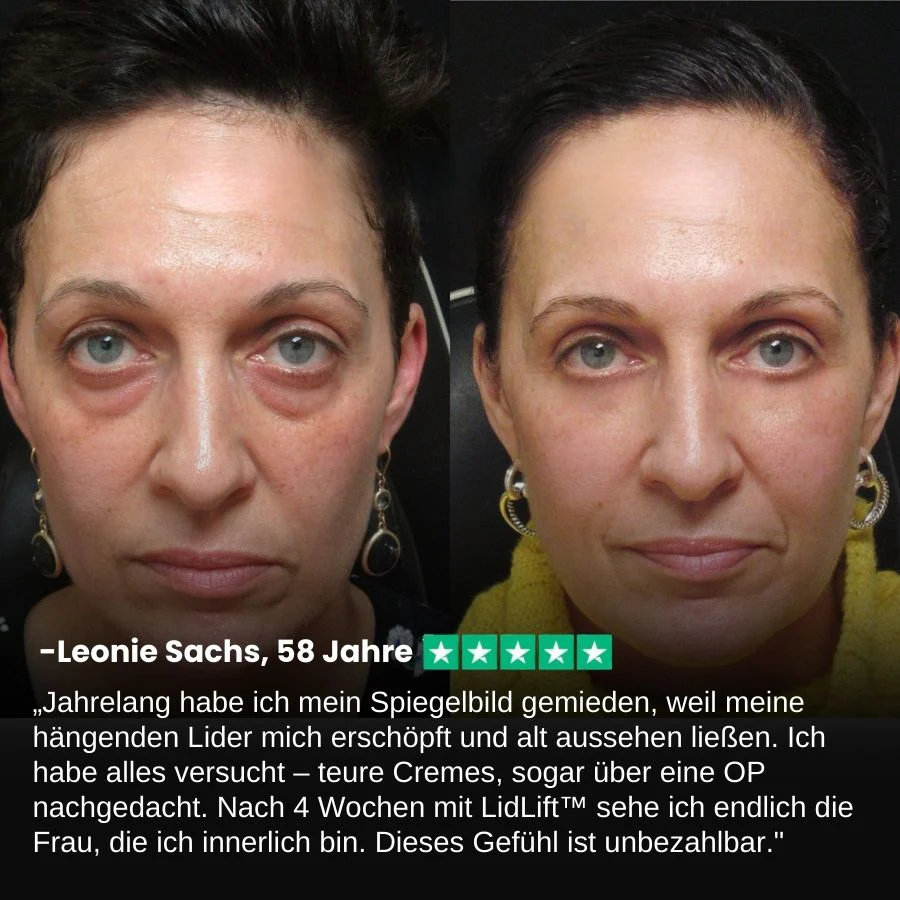 LidLift™ | Augenlid-Straffungscreme - Image 3