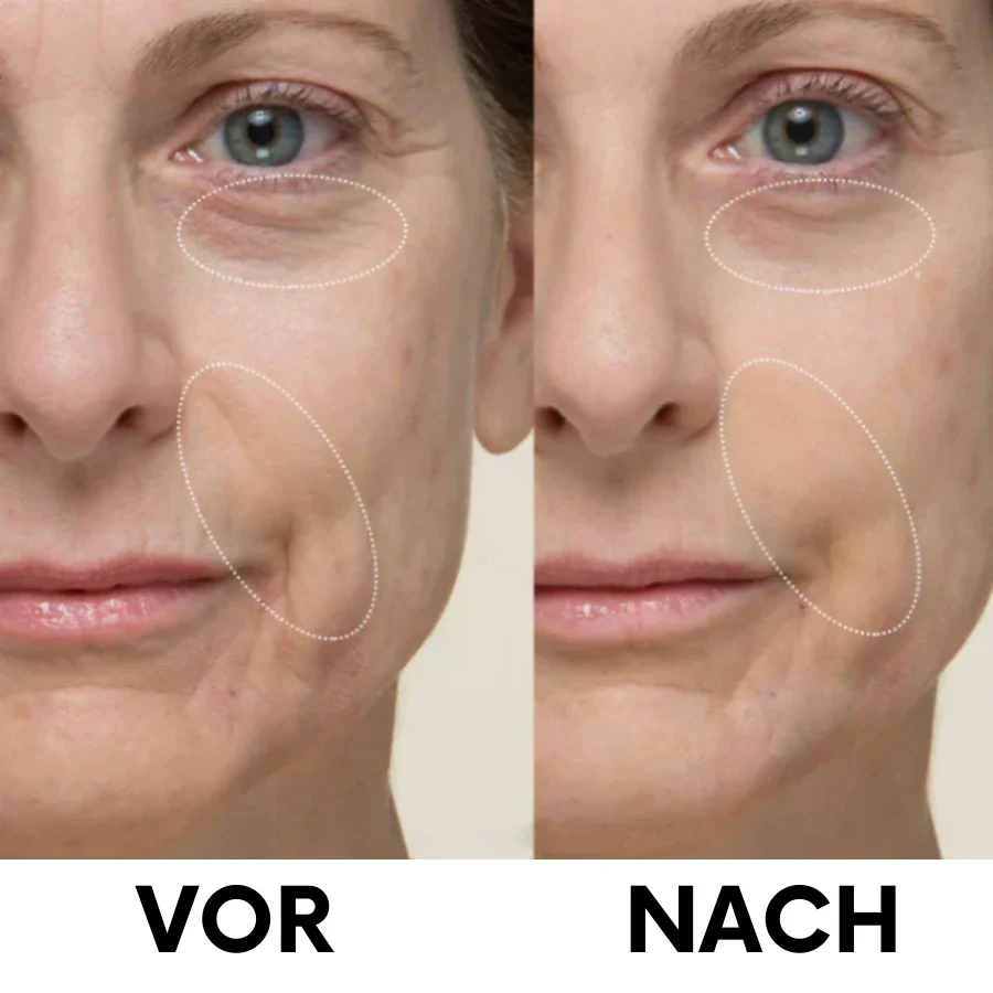 Liftéa™ | Sofort straffende Gesichtscreme - Image 7