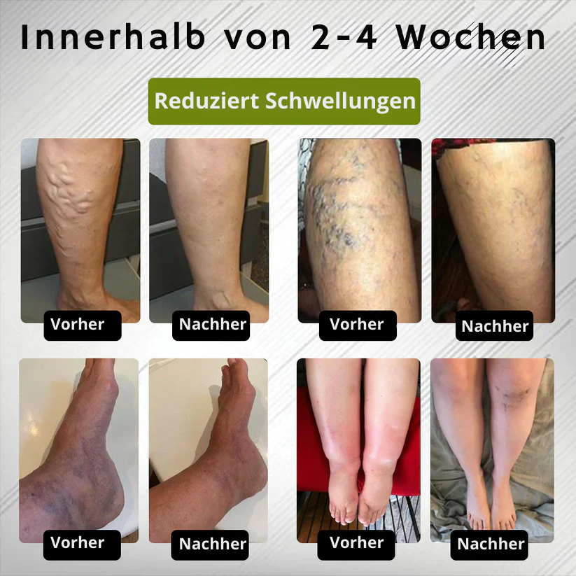 LinderSchritt™ | Besiege Fußschmerzen jetzt - Image 5