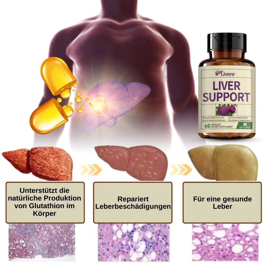 Livera™ | Kräuter-Nahrungsergänzungsmittel für Leberunterstützung - Image 4