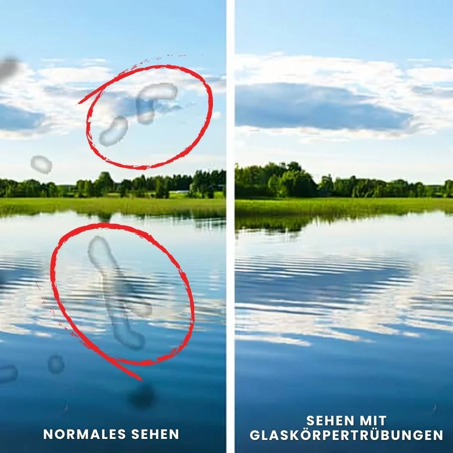 LuminEye™ | Fortschrittliche Unterstützung für Augen und Makula - Image 4