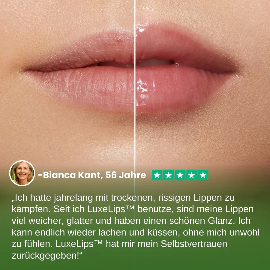 LuxeLips™ | Beruhigende Lippenpflege für natürliche Schönheit - Image 4