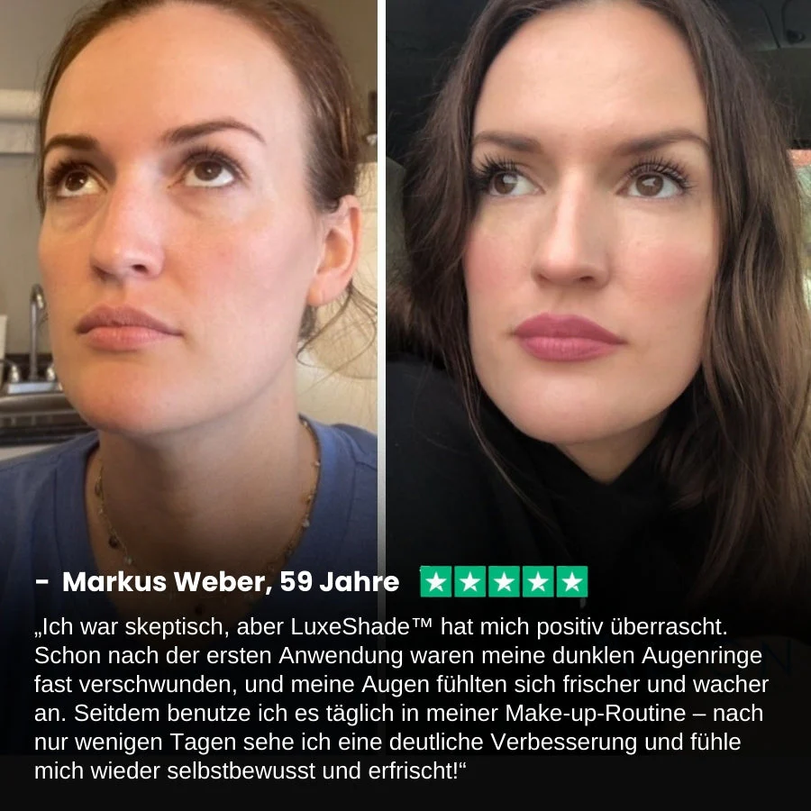 LuxeShade™ | Abdeckstift für dunkle Augenringe - Image 34