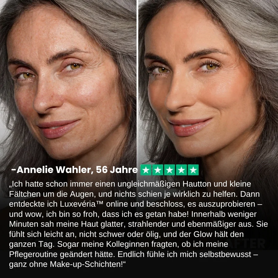 Luxevéria™ | Glättet sichtbar Falten in nur 2 Minuten – für strahlende Haut, die den ganzen Tag anhält! - Image 3