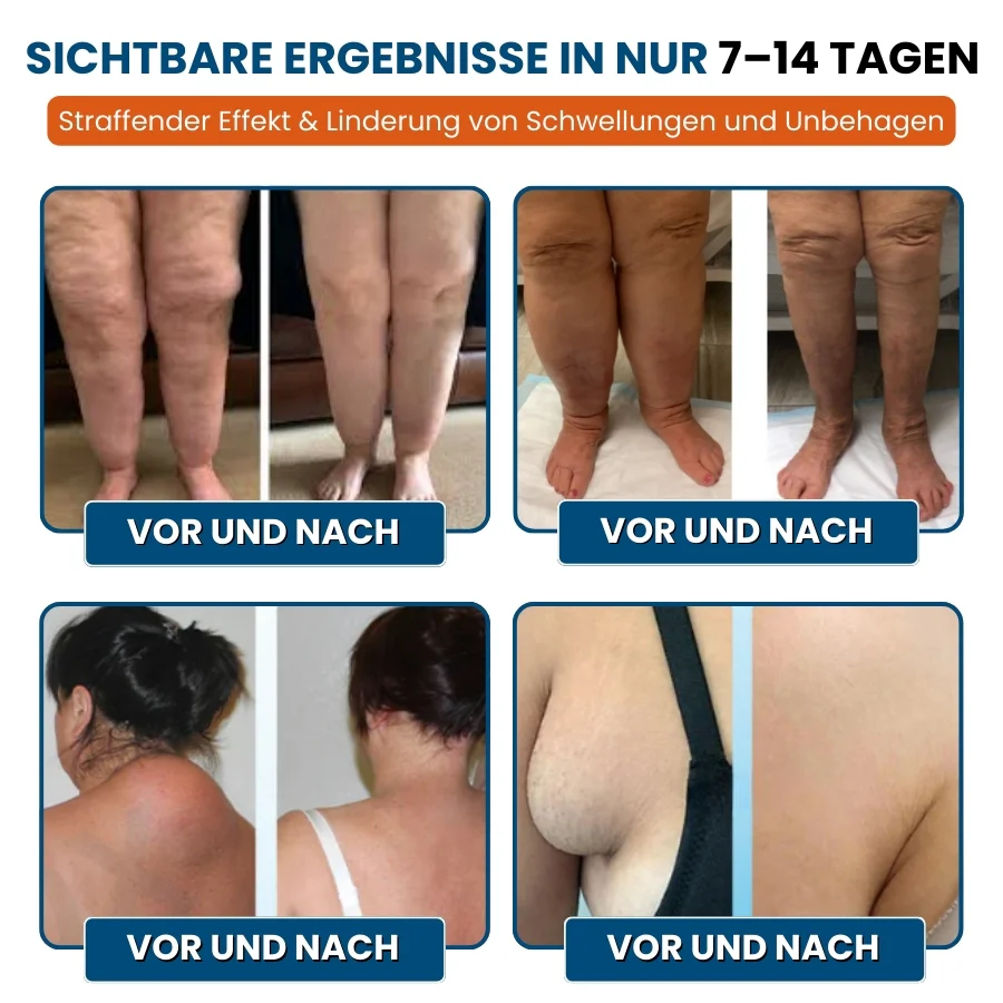 LymphoEase™ | Fühlen Sie sich in nur 14 Tagen leicht, entspannt und frei von Schwellungen - Image 8