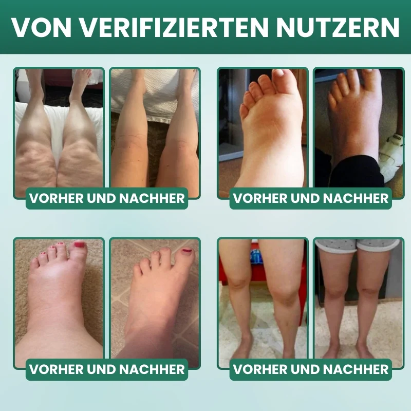 Lymphoria™ | Pflanzliche Unterstützung für Ihre Lymphe - Image 7