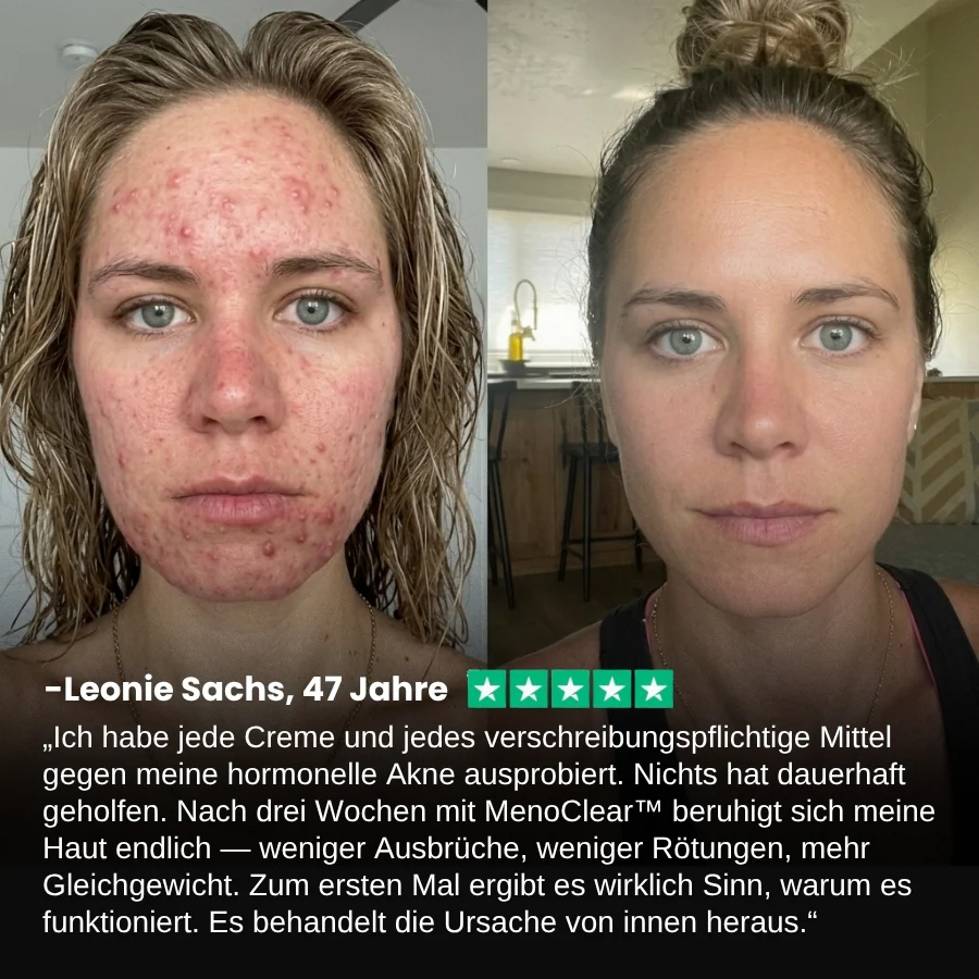 MenoClear™ | Akne-Gummis für die Menopause - Image 3