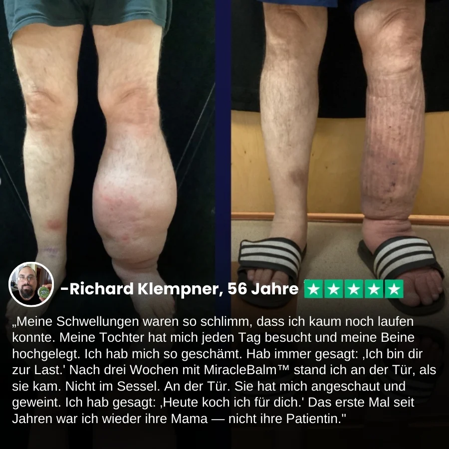 MiracleBalm™ | Beinschwellungen Linderndes Pflege-Balsam - Image 3