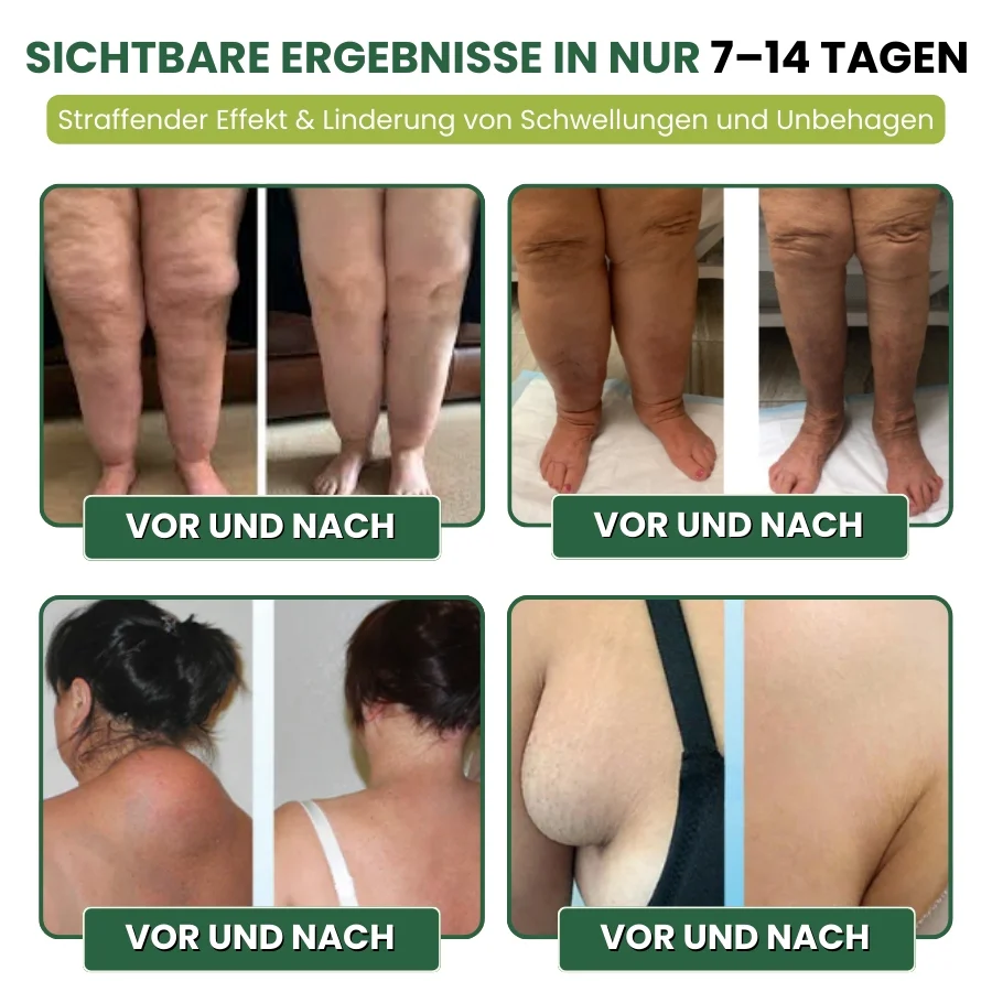 MiracleBalm™ | Beinschwellungen Linderndes Pflege-Balsam - Image 6