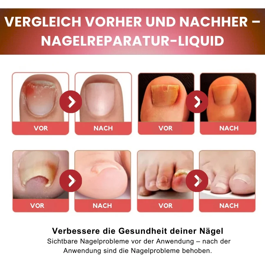NailCure™ | Fungi Nail Triple Action Formel - Image 2