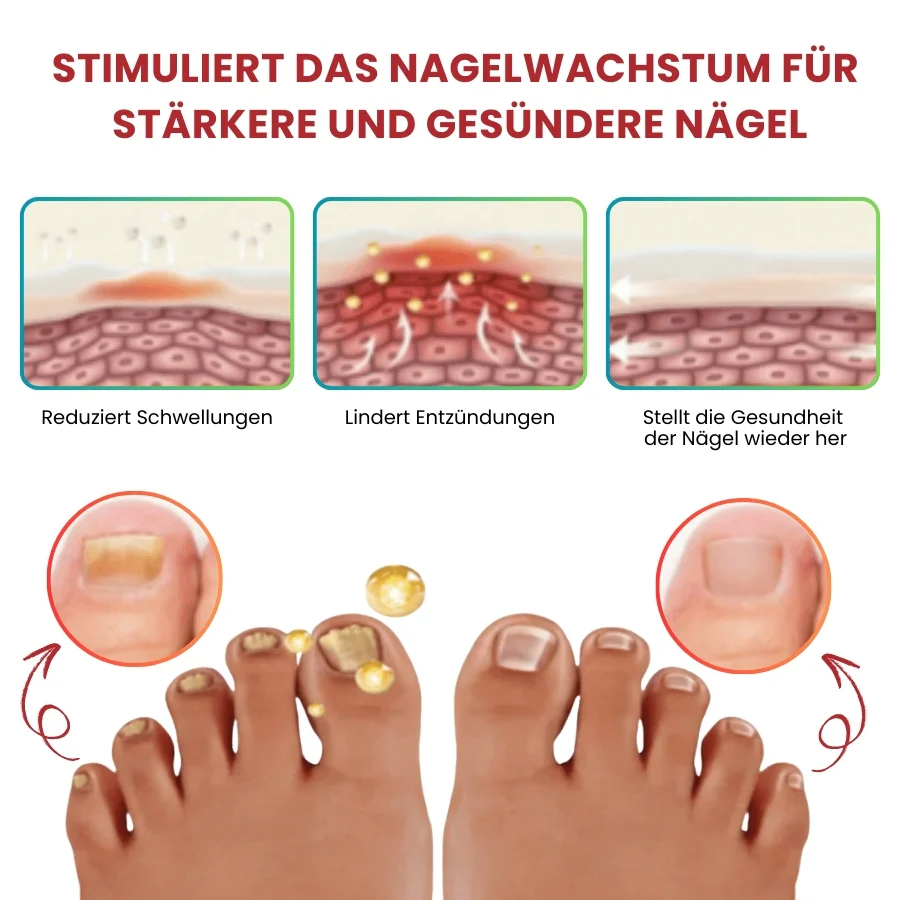 NailCure™ | Fungi Nail Triple Action Formel - Image 3