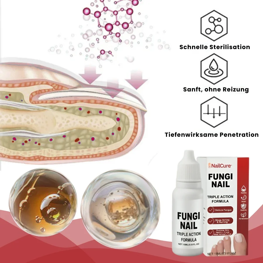 NailCure™ | Fungi Nail Triple Action Formel - Image 4