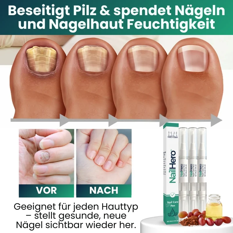 NailHero™ | Nagelpflegestift - Image 6