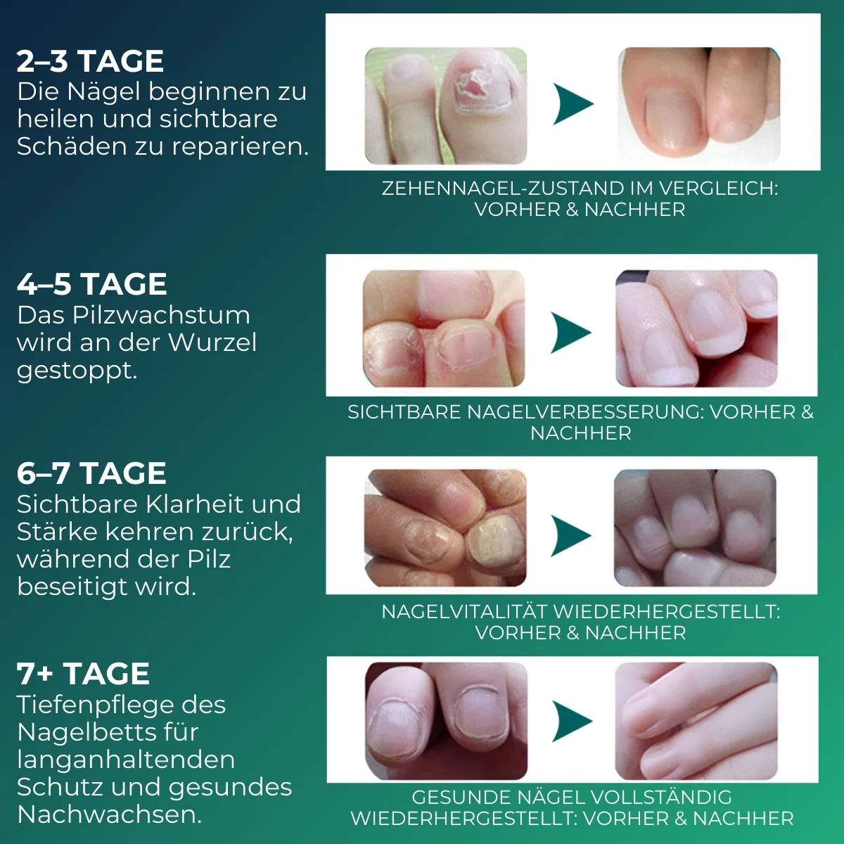 NailHero™ | Nagelpflegestift - Image 7