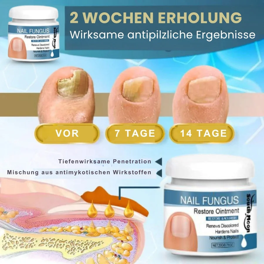 Nailixir™ | Nagelpilzbehandlungssalbe - Image 2