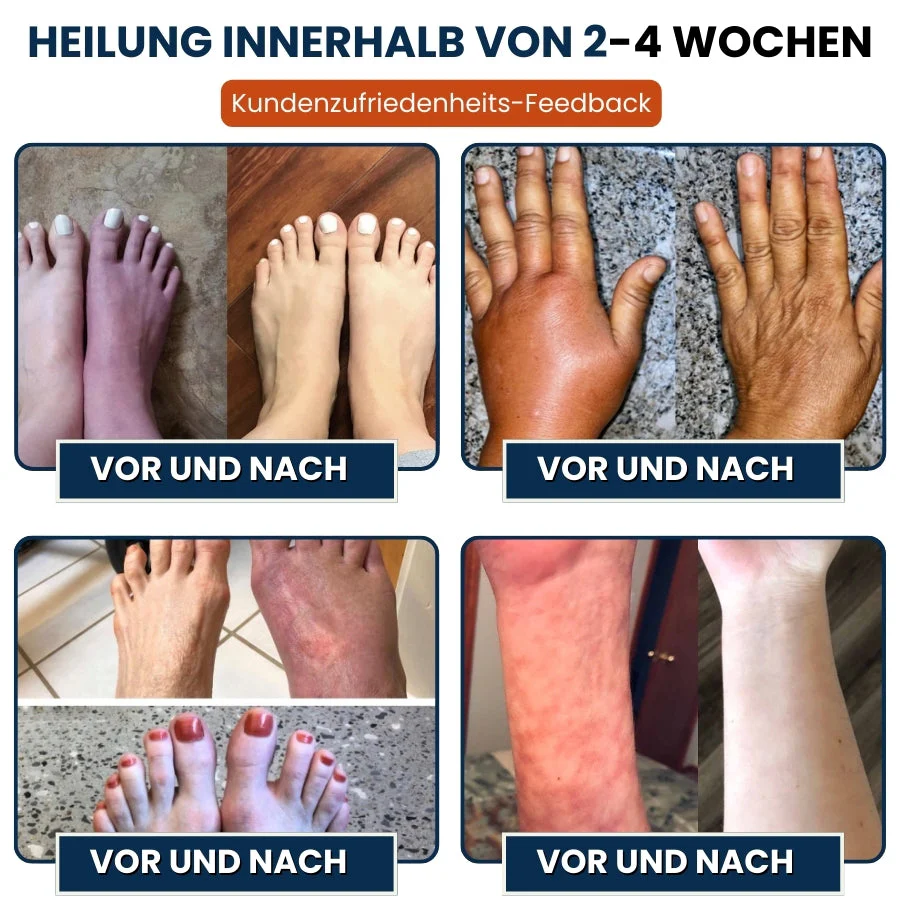 NerveFlex™ | Neuropathie NumbEase Reparaturpflaster - Image 6