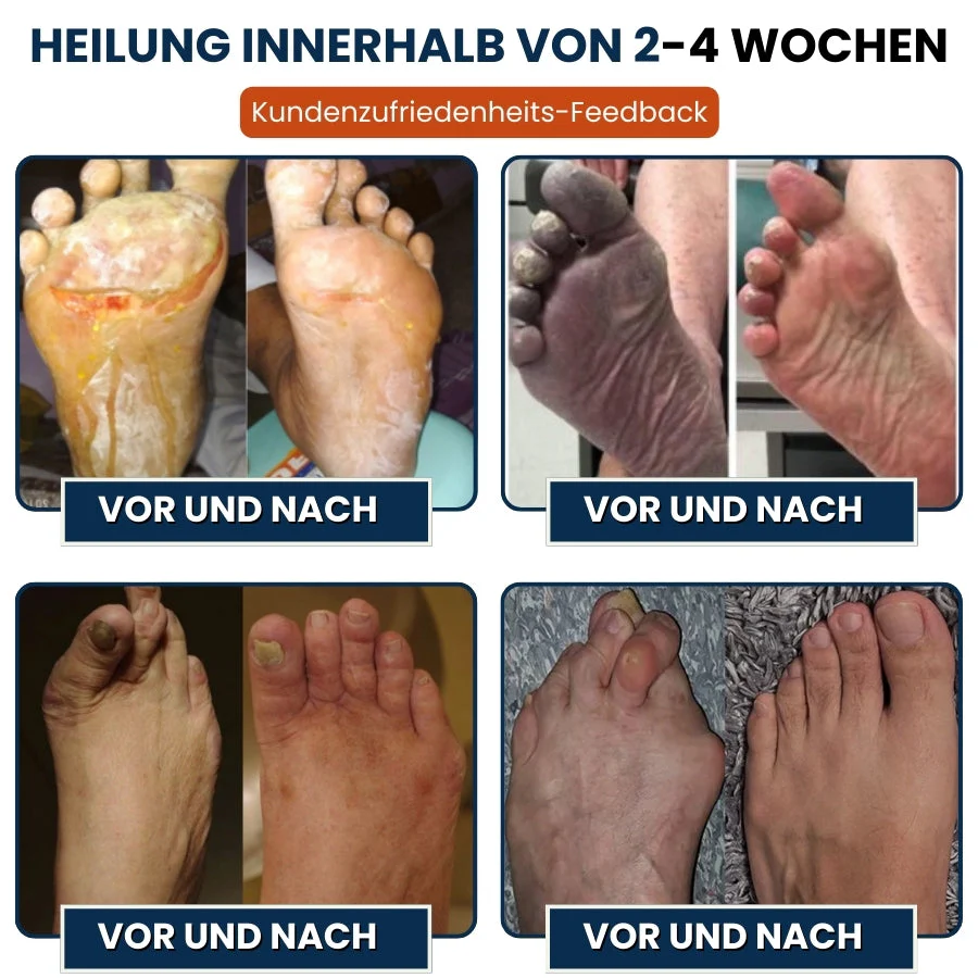 NerveFlex™ | Neuropathie NumbEase Reparaturpflaster - Image 7