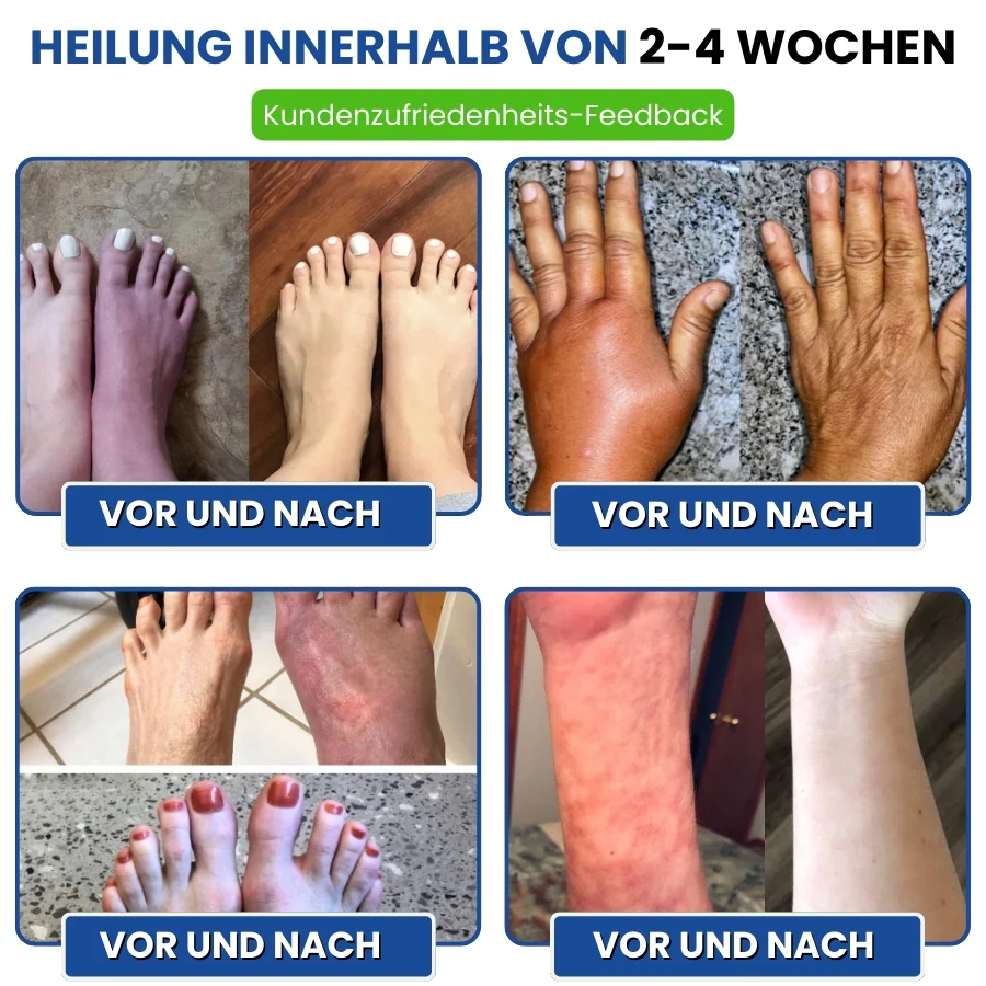 Nurovita™ | Natürlicher Creme für Neuropathie-Komfort - Image 10