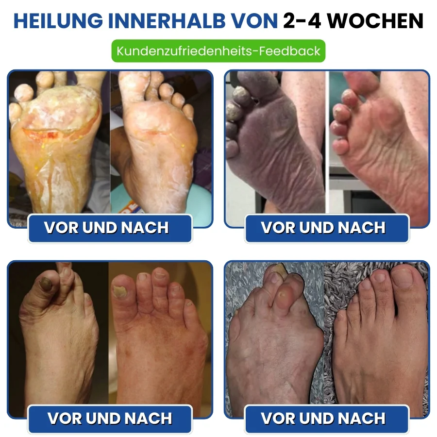 Nurovita™ | Natürlicher Creme für Neuropathie-Komfort - Image 9