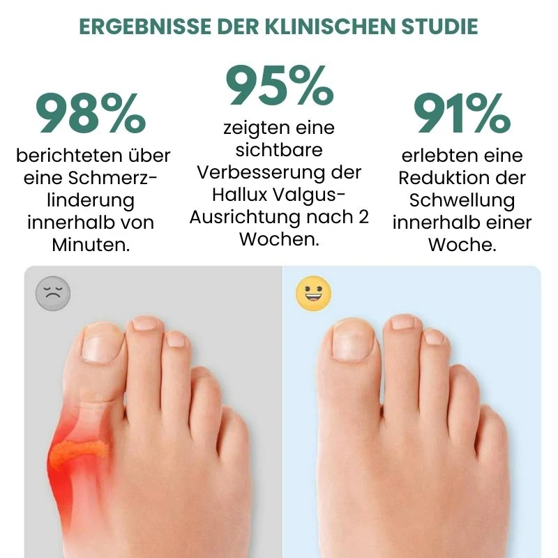OrthoAlign™ | Sichtbare Korrektur bei Hallux Valgus bereits ab der ersten Anwendung! - Image 2