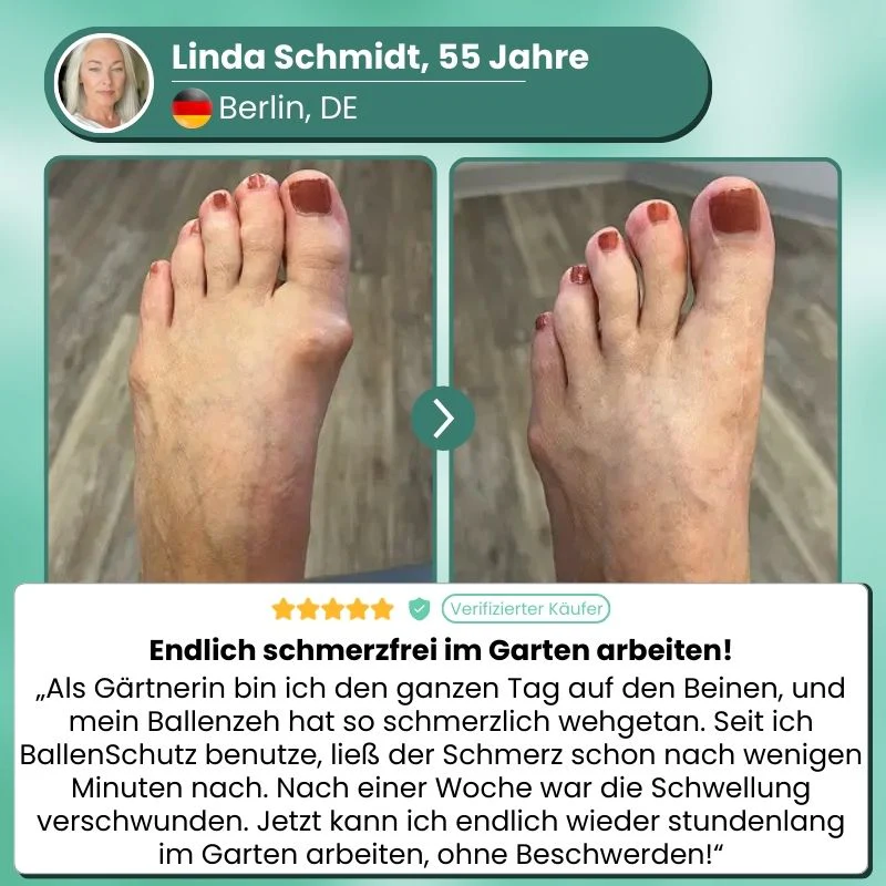 OrthoAlign™ | Sichtbare Korrektur bei Hallux Valgus bereits ab der ersten Anwendung! - Image 4