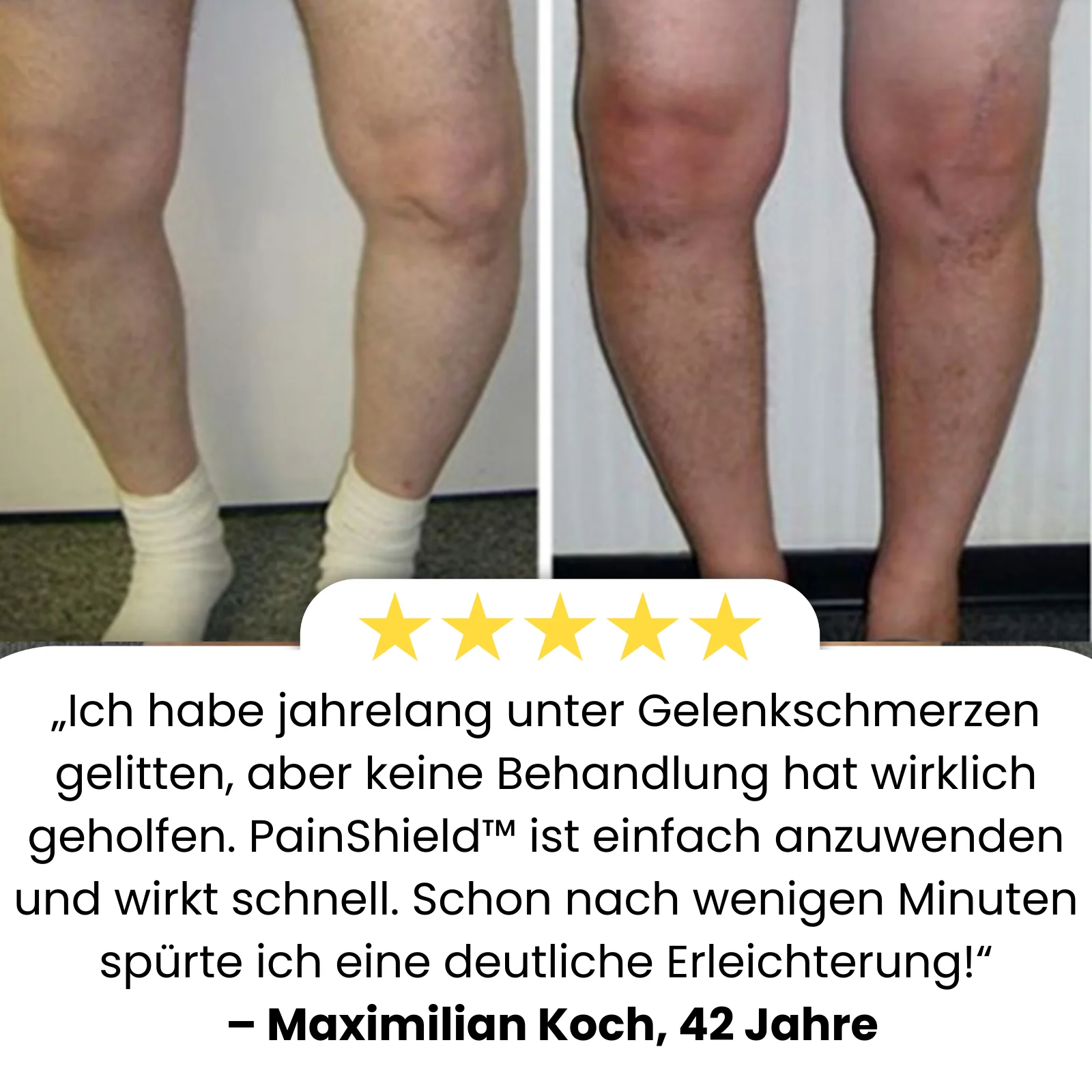 PainShield™ | 95 % Entzündung in 7 Tagen! - Image 3