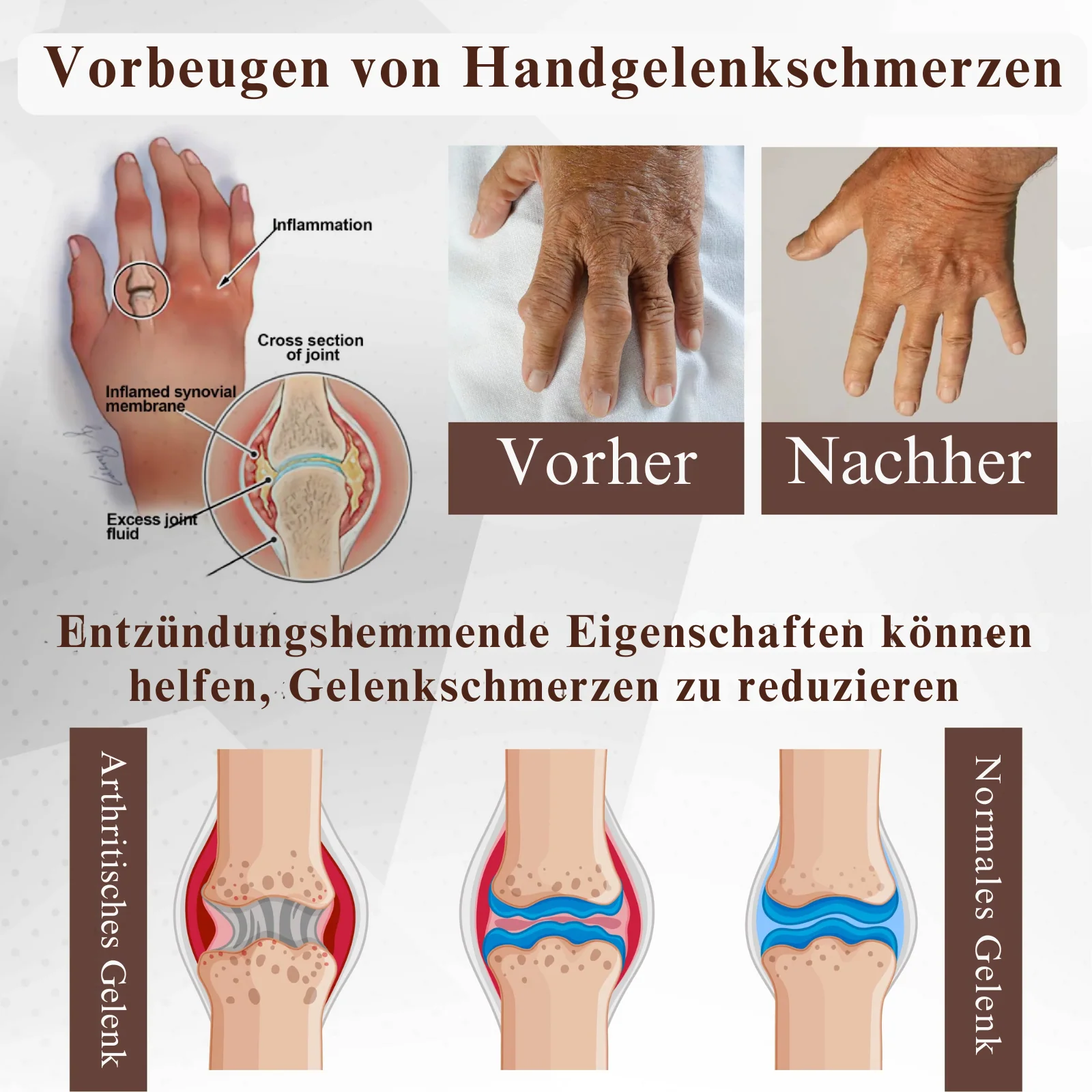 PainShield™ | 95 % Entzündung in 7 Tagen! - Image 5