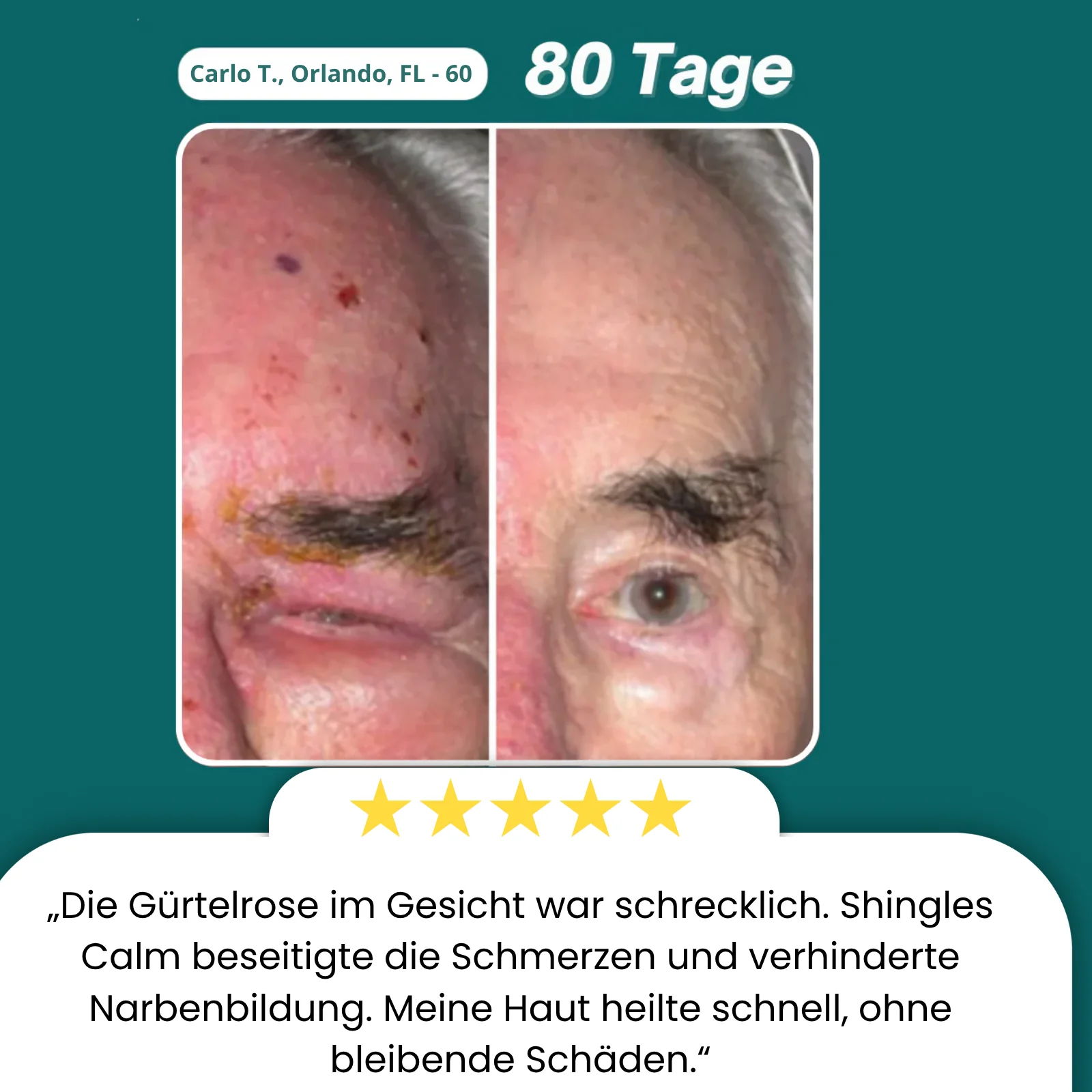 PeptideRelief™ | Beende Nervenqualen in 7 Tagen! - Image 3