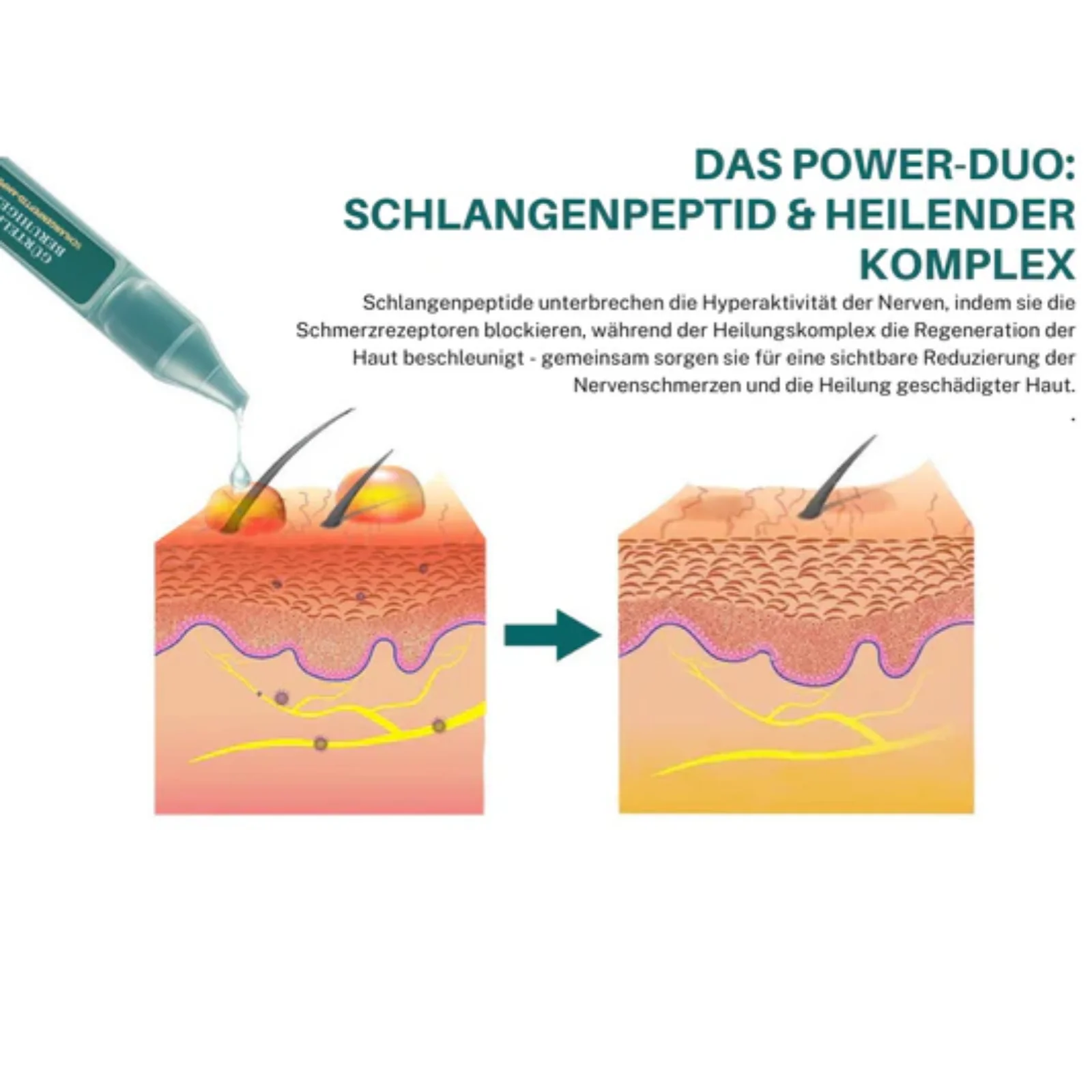 PeptideRelief™ | Beende Nervenqualen in 7 Tagen! - Image 7